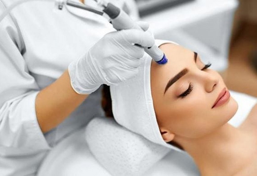 MICRODERMOABRASIÓN_39